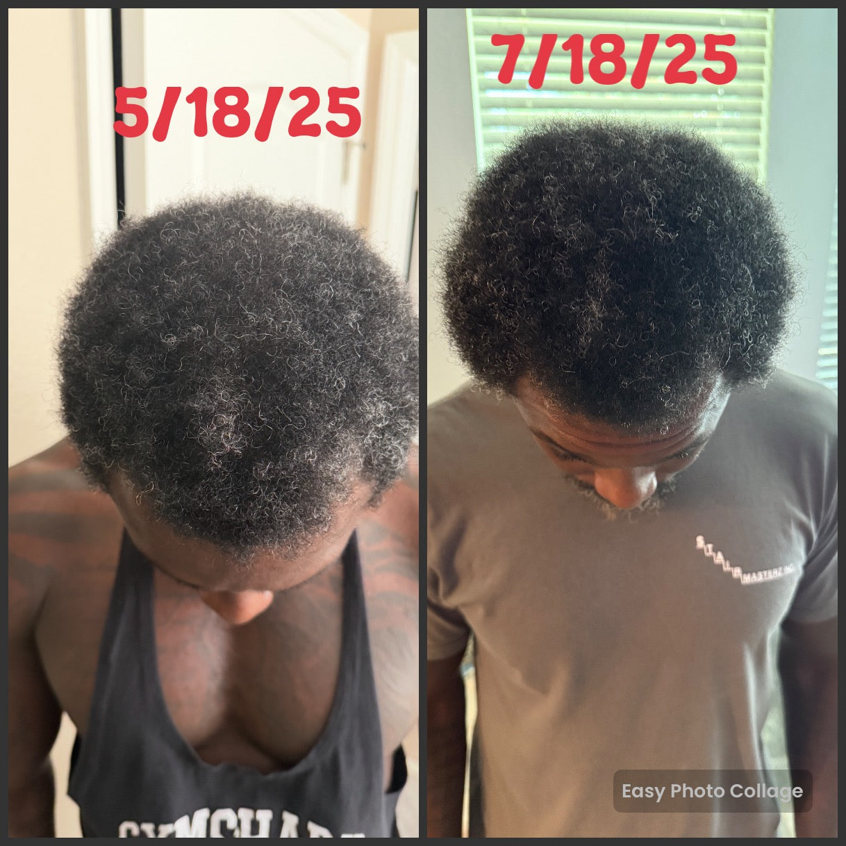 NATURAL HERB 🌿 HAIR GROWTH OIL