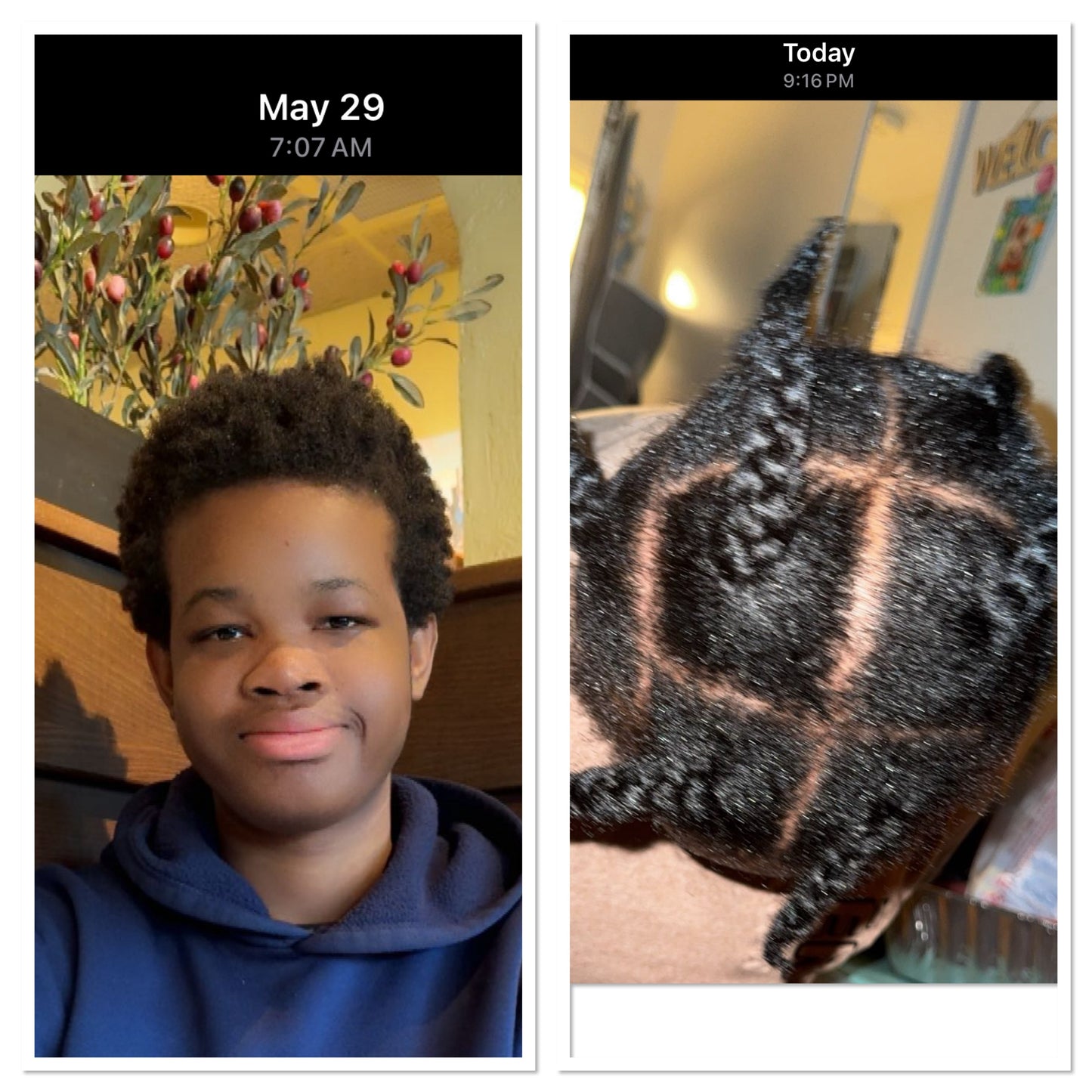 NATURAL HERB 🌿 HAIR GROWTH OIL