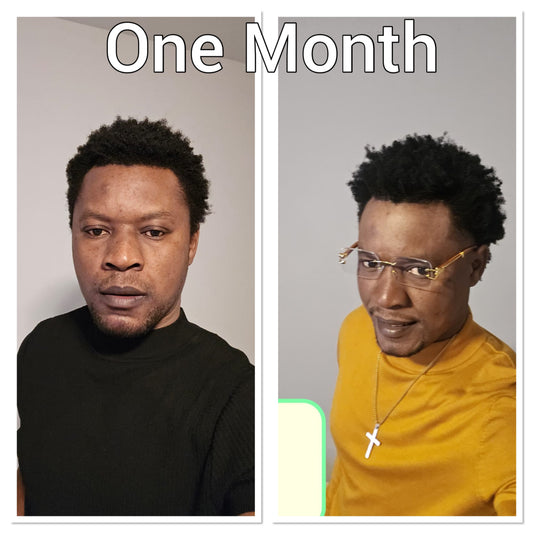 NATURAL HERB 🌿 HAIR GROWTH