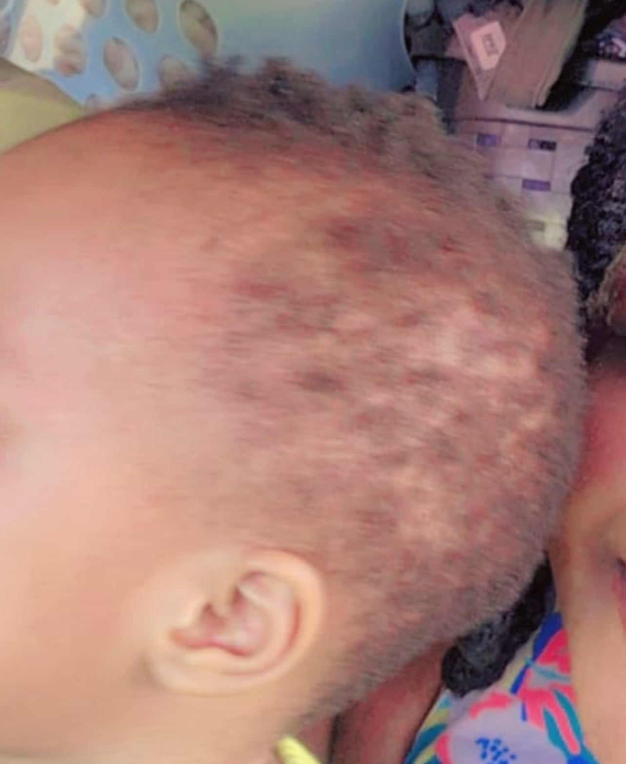 NATURAL HERB 🌿 HAIR GROWTH GREASE/POMADE