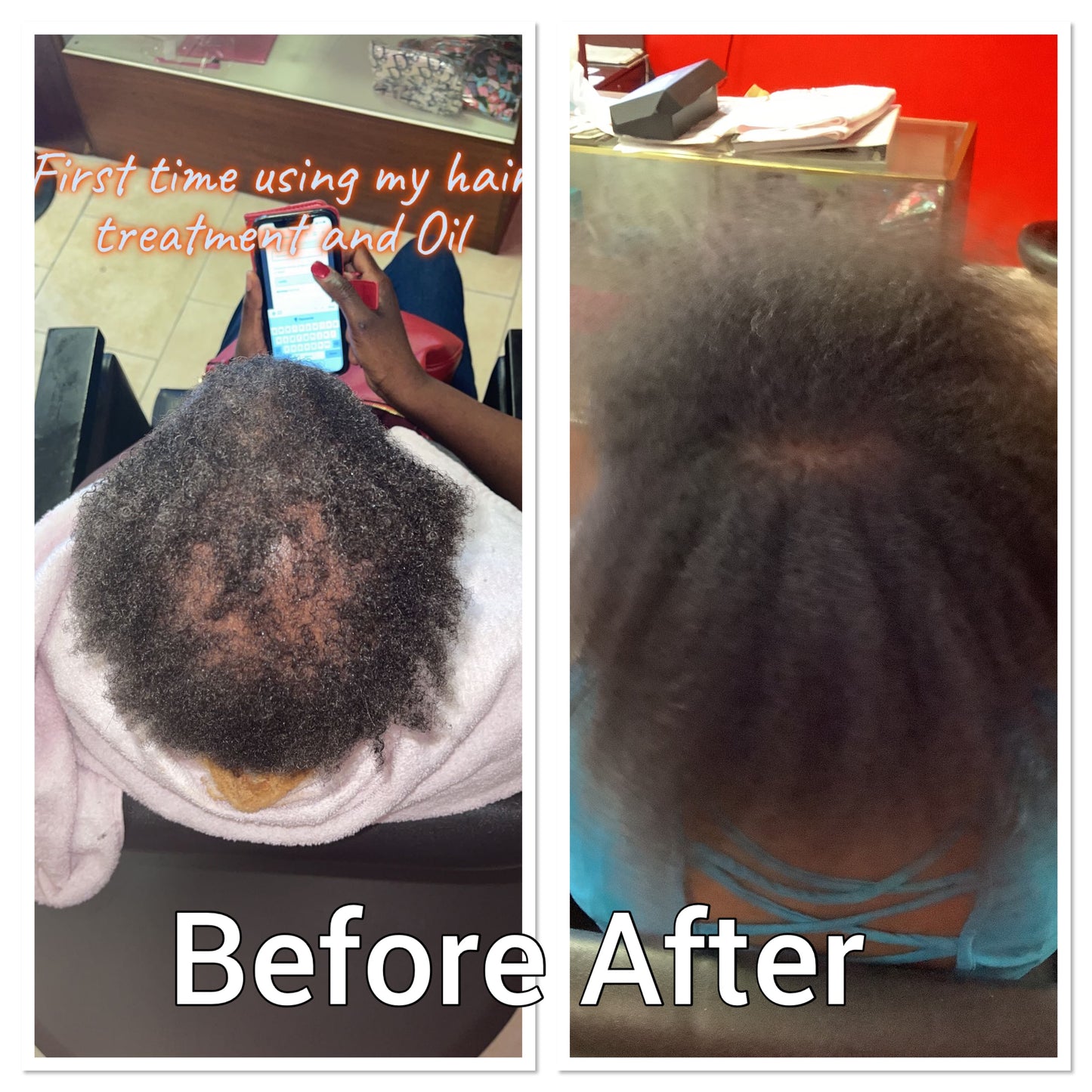 NATURAL HERB 🌿 HAIR GROWTH OIL