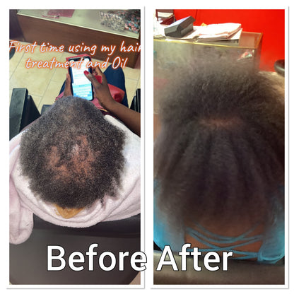 NATURAL HERB 🌿 HAIR GROWTH OIL