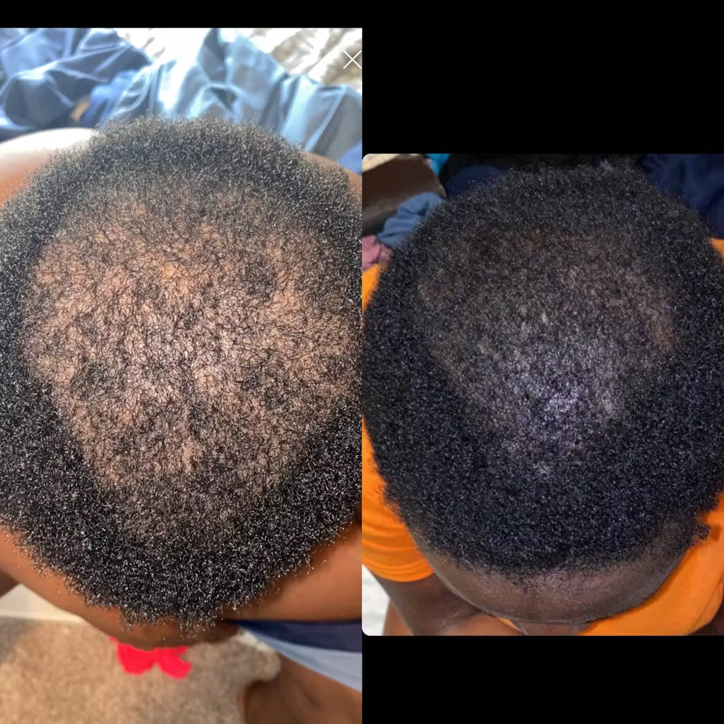 NATURAL HERB 🌿 HAIR GROWTH OIL